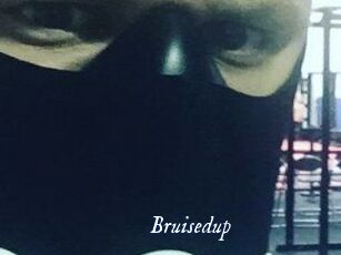 Bruisedup